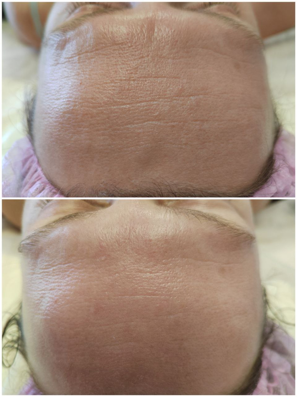 Смотрите, какая акция: массаж и чистка лица, \"Anti-age\" уход ...